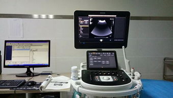 旬陽縣醫院成功引進先進超聲設備，正式開通新生兒顱腦超聲檢查服務